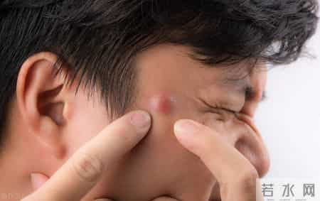 蒲公英教案,五味消毒饮，专为治疗大而深的痘痘而创的方子