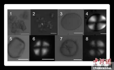 东周时期贵族饮食考古发现：女性食源多样肉食明显低于男性