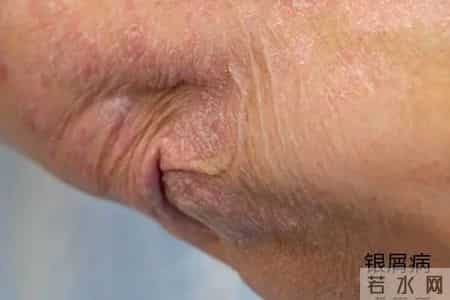 2013年护士执业资格考试分数线