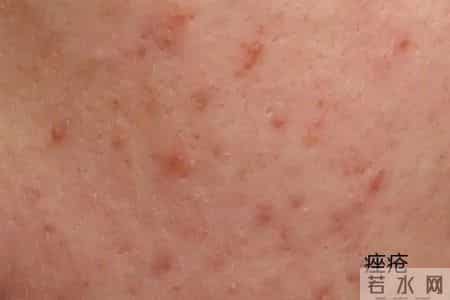 2013年护士执业资格考试分数线