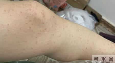 广东新增本土确诊47例,广东佛山顺德区确诊478例 小心这种由“花蚊子”传染的病