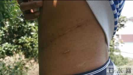 废弃厂房里的“卖肾”交易：买肾人花55万，卖肾人得4.5万