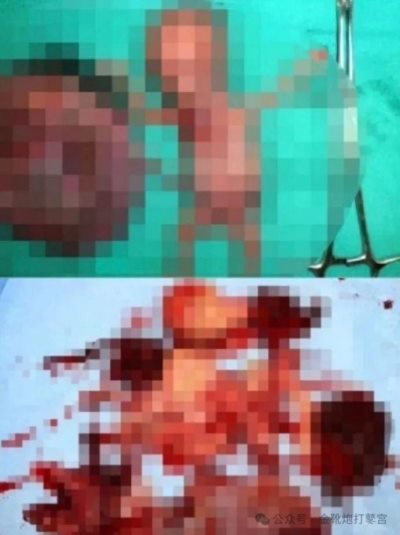 欧洲金靴-青岛代孕案与韩国N号房：性犯罪背后的社会失衡