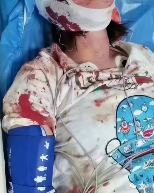 万事皆有因，唐山恶性打人案成因在哪？