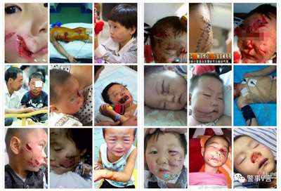 极端狗奴们为何再次集体沉默不语了？